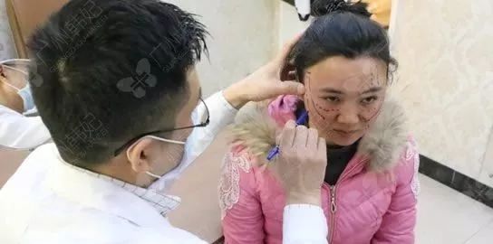 廣州韓妃美版超聲提拉和埋線提升提升日記一則，給你好看~