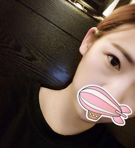 重慶五洲整形醫(yī)院醫(yī)生技術(shù)口碑|雙眼皮案例實(shí)記分享