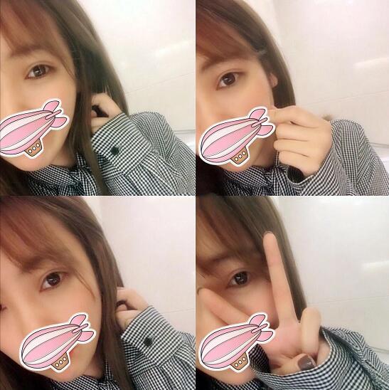 重慶五洲整形醫(yī)院醫(yī)生技術(shù)口碑|雙眼皮案例實(shí)記分享