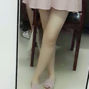 看看我大腿吸脂的恢復(fù)果圖片吧，是東方和諧王自謙做的