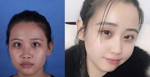 好消息!南寧華美10月20-21日邀請(qǐng)廖連平、劉志剛和徐艦來院坐診~