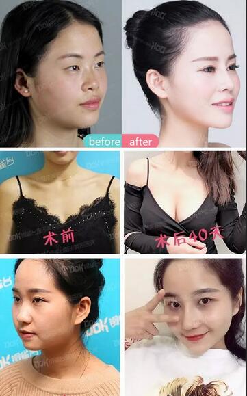 成都銅雀臺真人案例