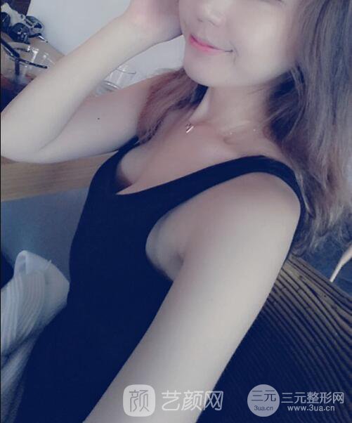 北京隆胸抽脂多少錢?北京東方和諧自體脂肪豐胸案例