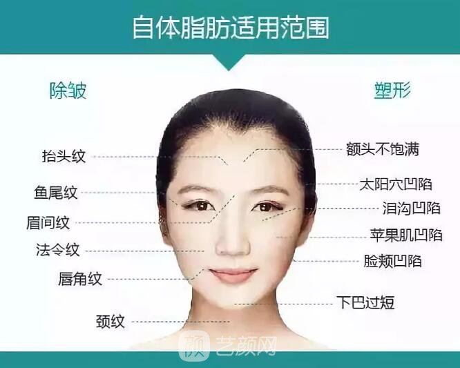 重慶當(dāng)代整形醫(yī)院自體脂肪填充照真人案例