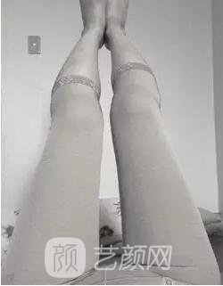 東莞締美陳星光大腿吸脂照片 內(nèi)附全部恢復(fù)過程體驗(yàn)