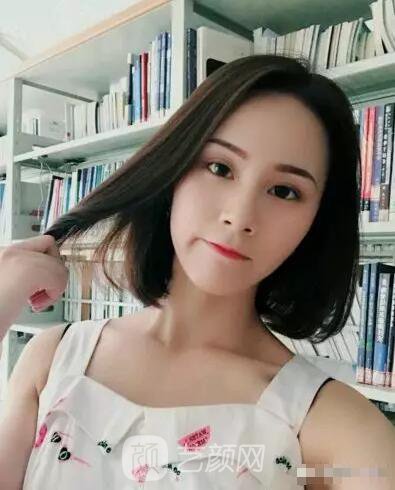 北京上上相鄭楚蓉院長(zhǎng)自體脂肪填充全臉圖心情小記