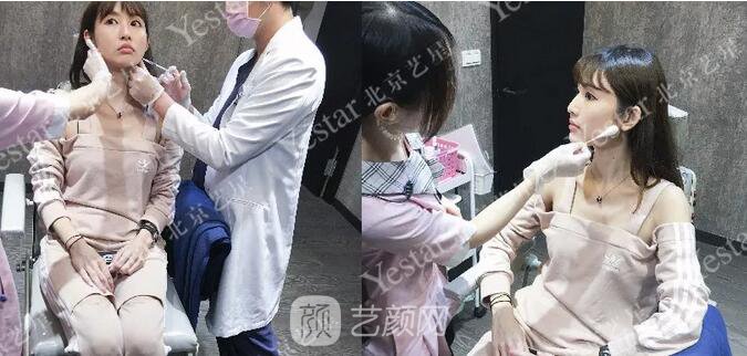 北京藝星整形醫(yī)院注射瘦臉￥499 | 打完半個(gè)月，來看看果!