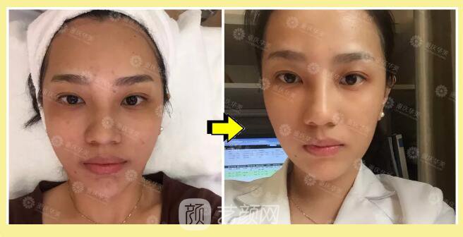 重慶華美整形【雙11今日開搶】14款醫(yī)美尖貨更低11元，驚爆特價!保價!