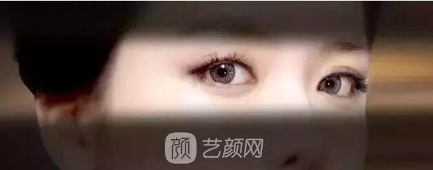 北京藝星整形Yestar分齡祛眼袋真實(shí)案例圖分享哦~