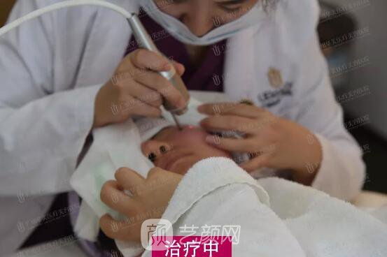 皮-秒激光祛斑案例，恢復照片分享~