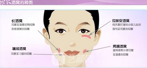 人造酒窩貴嗎？需要多少錢?