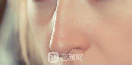 北京做修復(fù)鼻子需要多少錢？