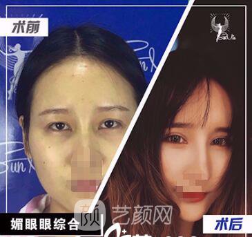 戴劍醫(yī)生案例