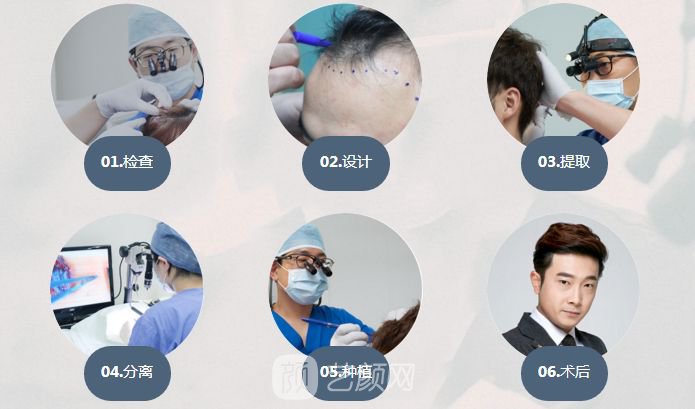 杭州植發(fā)手術費用大概多少?