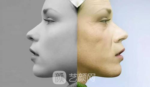 膠原蛋白除皺價格?