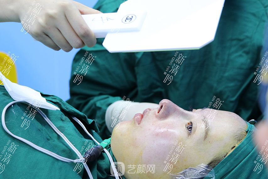 耳軟骨隆鼻果圖分享，術(shù)后~