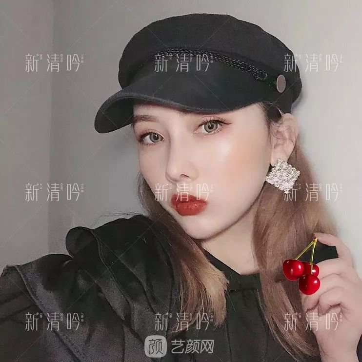 耳軟骨隆鼻果怎么樣？案例照片一覽~