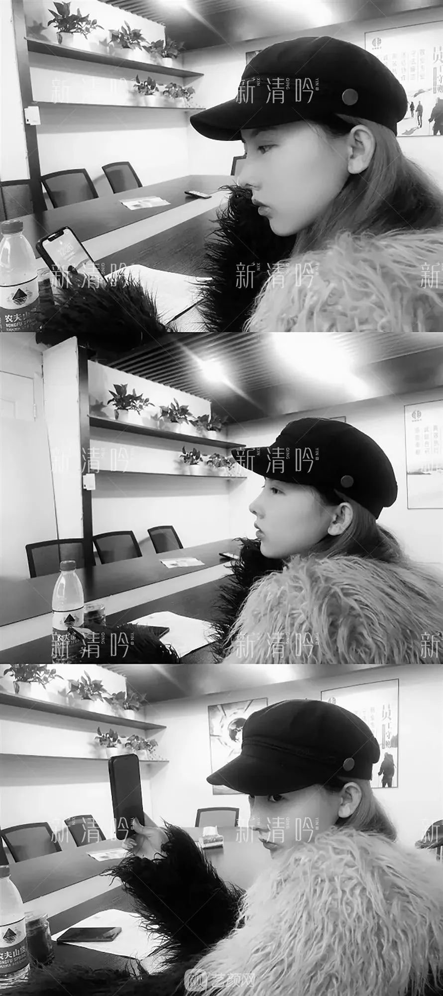 耳軟骨隆鼻果怎么樣？案例照片一覽~