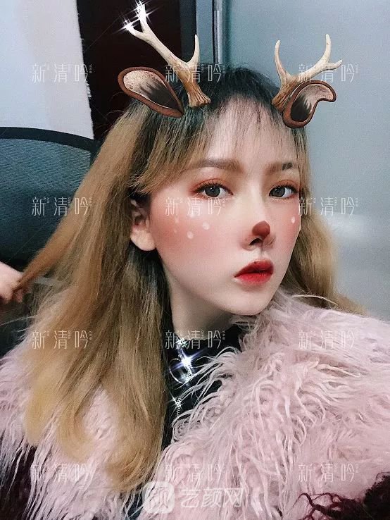 耳軟骨隆鼻果怎么樣？案例照片一覽~