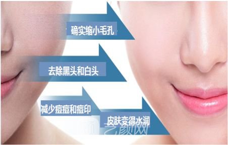 做一次黑臉娃娃需要多少錢?