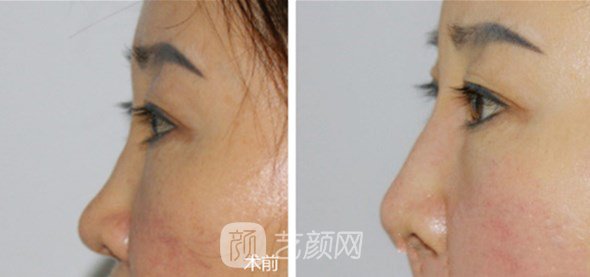 張維醫(yī)生案例