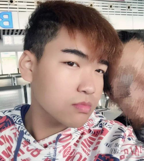 眼部手術(shù)案例——昆明募藍術(shù)后一年果照片分享~