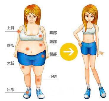 吸脂減肥塑型多少錢?