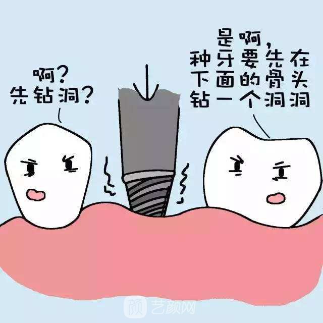 種植牙費(fèi)用多少