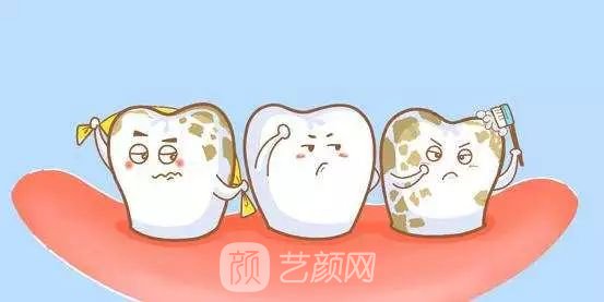 【牙貼面多少錢一顆？】