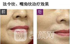 劉娟醫(yī)生案例