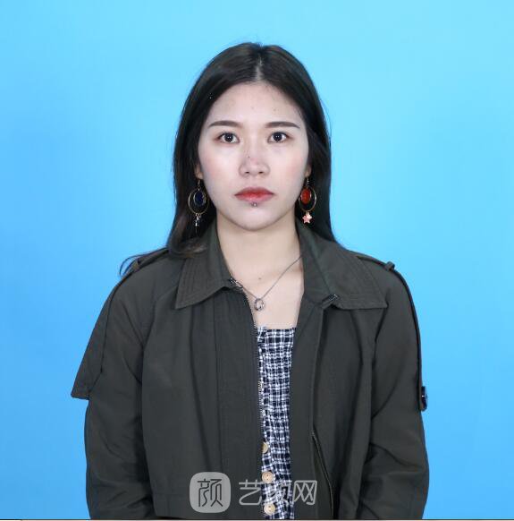 開眼角圖真實案例分享哦