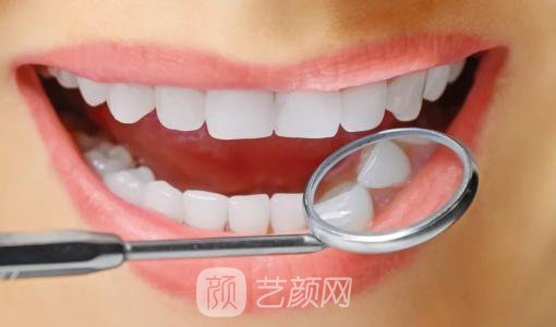 美白牙齒需要多少錢?