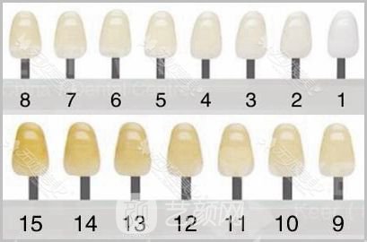 美白牙齒需要多少錢?