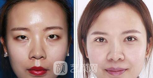 高鍔醫(yī)生案例