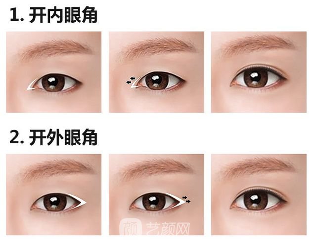 上海韓式開(kāi)眼角多少錢(qián)?