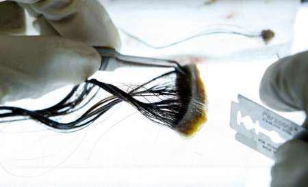 睫毛移植多少錢(qián)?