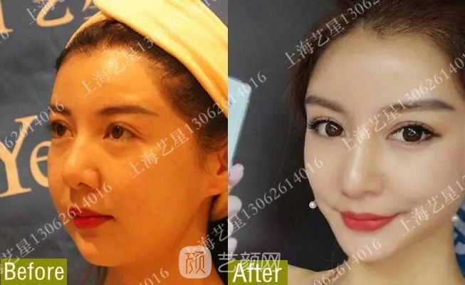 《愛情公寓》集體變臉！離婚的她才20歲？ 