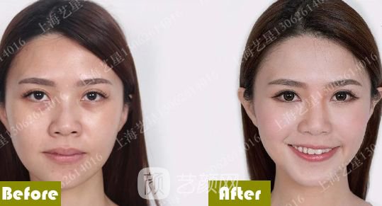 《愛情公寓》集體變臉！離婚的她才20歲？ 