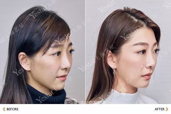 《愛情公寓》集體變臉！離婚的她才20歲？ 