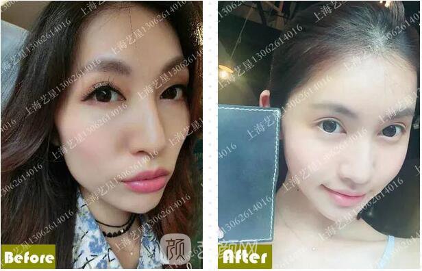 《愛情公寓》集體變臉！離婚的她才20歲？ 