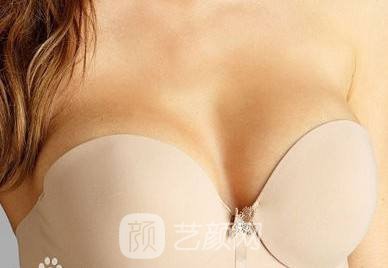 杭州韓式隆胸整形費(fèi)用?