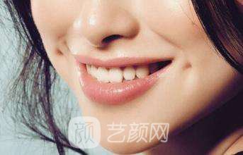 廈門人造酒窩價(jià)格?