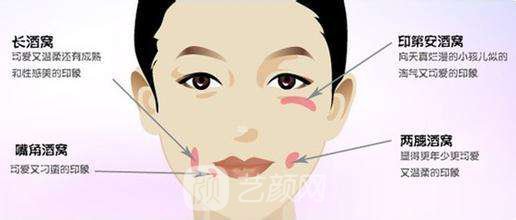 廈門人造酒窩價(jià)格?