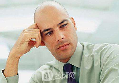 頭發(fā)移植費用多少錢呢