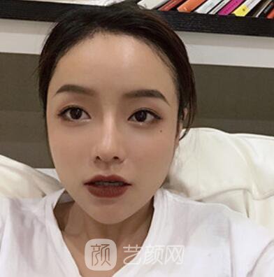 做好發(fā)際線后堪比微調(diào)的真實(shí)經(jīng)歷分享