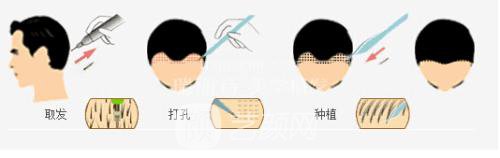 成都種植睫毛多少錢?