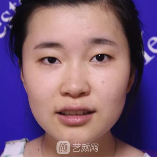 出道三年，她整成這樣終于亮相芒果臺啦！