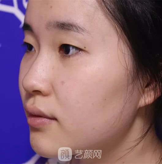 出道三年，她整成這樣終于亮相芒果臺啦！