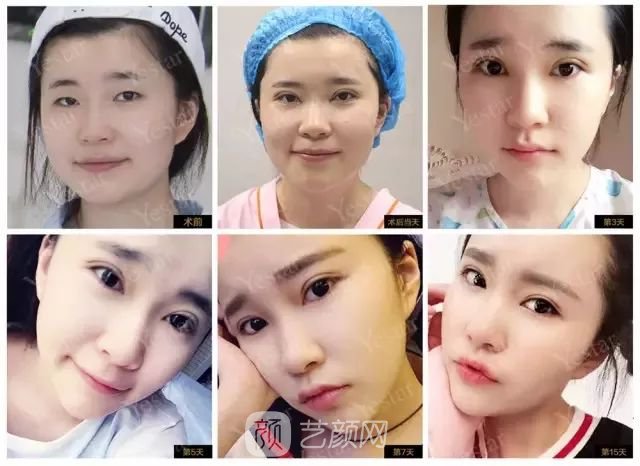 出道三年，她整成這樣終于亮相芒果臺啦！