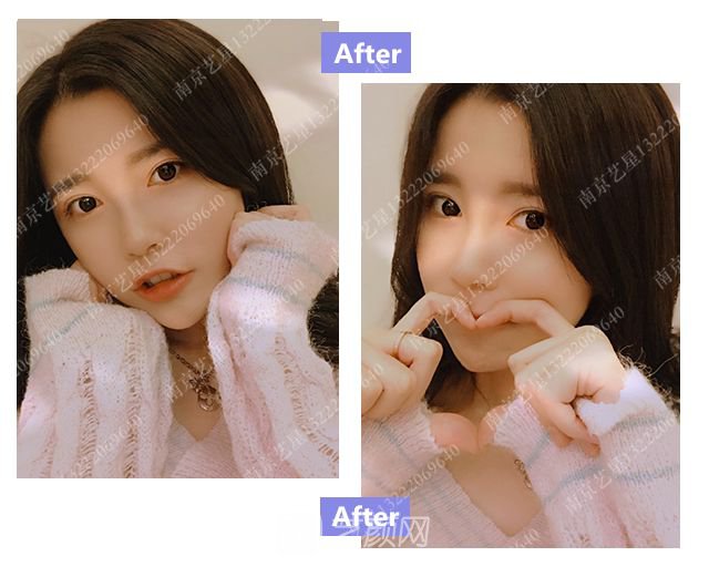 出道三年，她整成這樣終于亮相芒果臺啦！